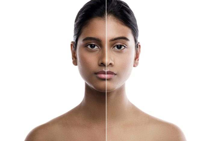 Inside the Billion-Dollar Industry That Profits from Colorism—and the Lives It Silently Wounds